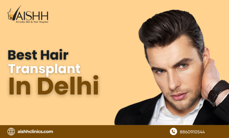 Best Hair Transplant in Delhi