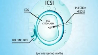 icsi male infertility