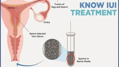 iui treatment