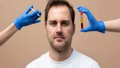 PRP Treatment for Hair Loss